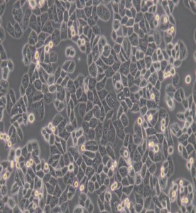 MDA-MB-468人乳腺癌细胞(L15)主图