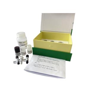 同型半胱氨酸(HCY)(酶循环法)含量检测试剂盒微板法48样