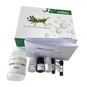 Annexin V-FITC细胞凋亡检测试剂盒(TMR红色荧光)主图